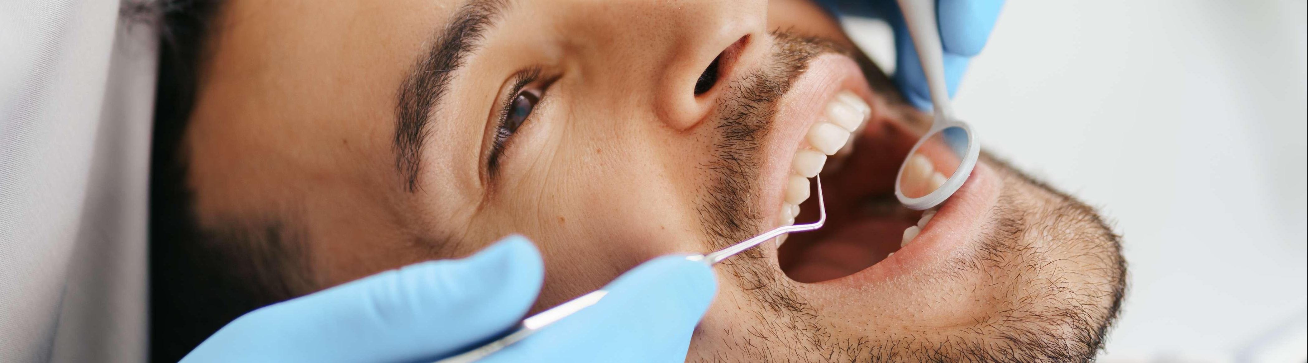 Invisalign Clear Aligners 
