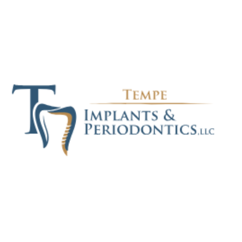 Mesa All On 4  Dental Implants
